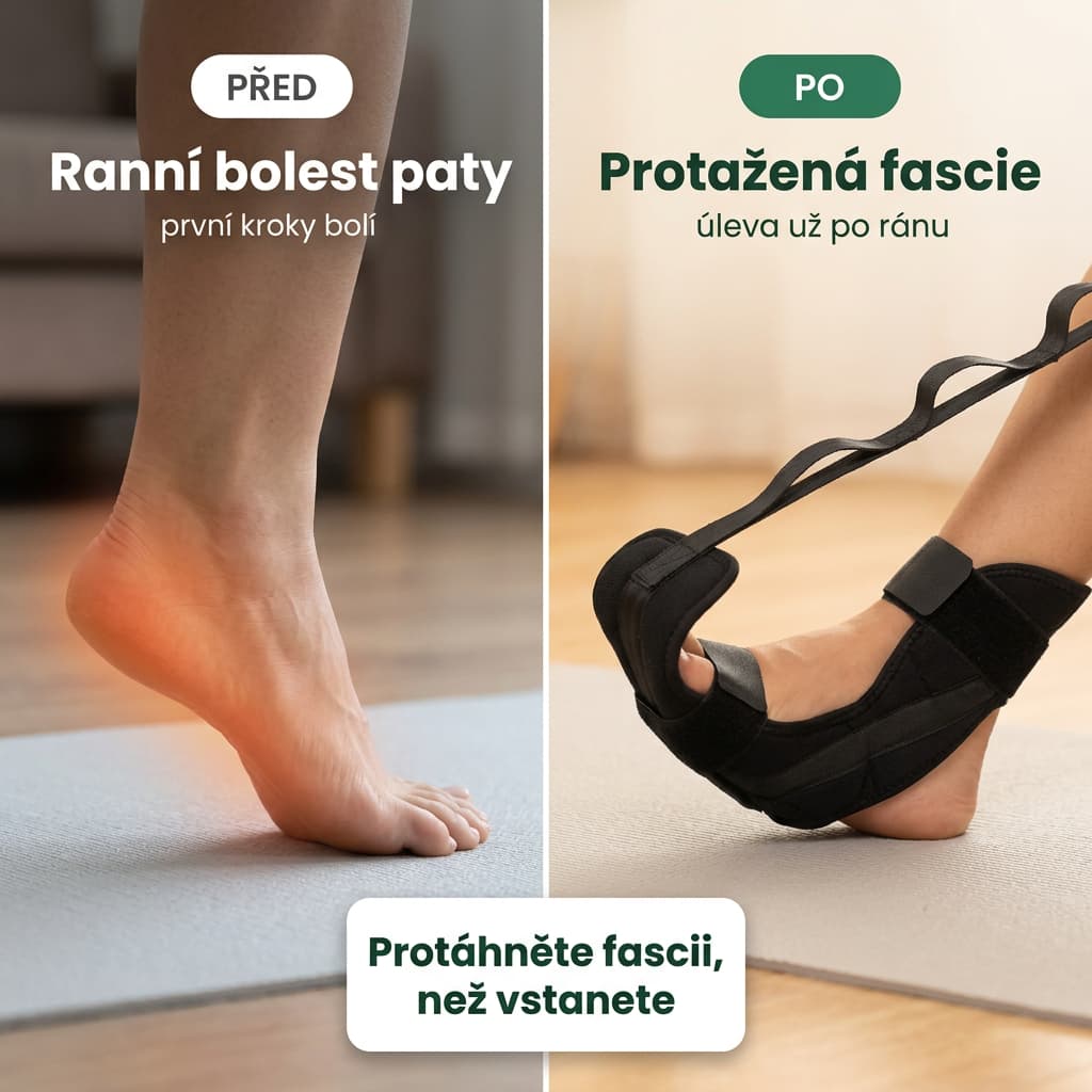 Strečovací popruh na chodidlo před a po – protažená plantární fascie